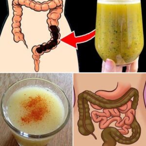 How to Colon Cleansing Help You Detox, Lose Weight Naturally
