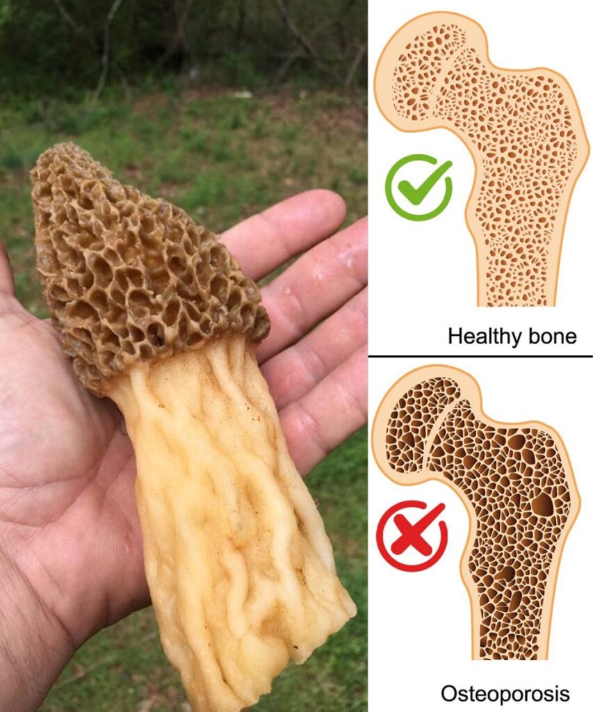 Morel Mushroom Benefits: Wild Delicacy with Big Health Value