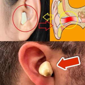 Restore Hearing Naturally With Garlic and Onion