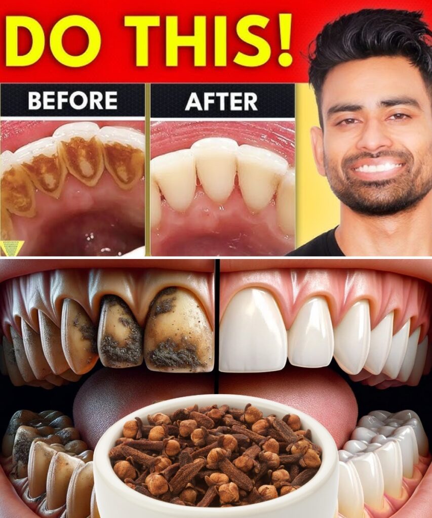 9 Natural Ways to Remove Plaque and Tartar