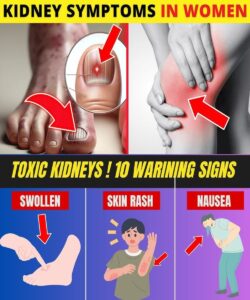 Goji Berry and Kidney Health: Spotting Subtle Signs of Kidney Disease