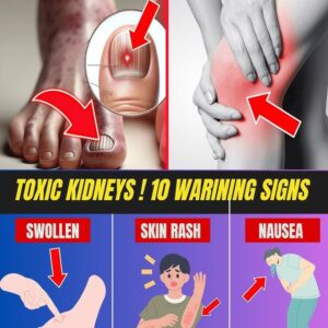 Goji Berry and Kidney Health: Spotting Subtle Signs of Kidney Disease