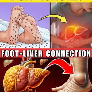 Foot Liver Warning Signs: Spotting Health Risks Early