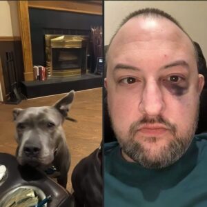 Heroic Rescue Pit Bulls Thwart Violent Carjacking Attack